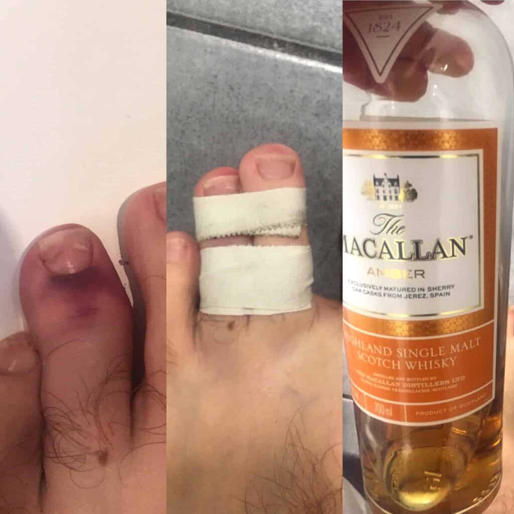 Broken Toes and Whisky